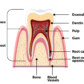 root canal treatment singapore